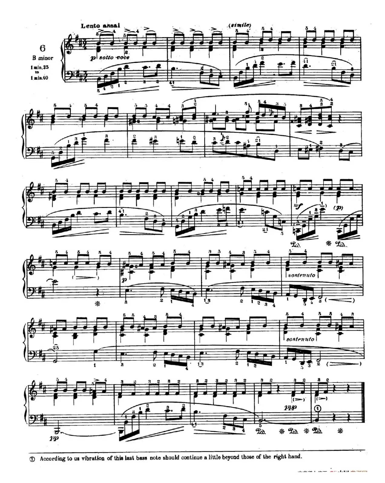 Preludes Op.28（24首前奏曲·6）
